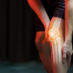 knee pain when bending