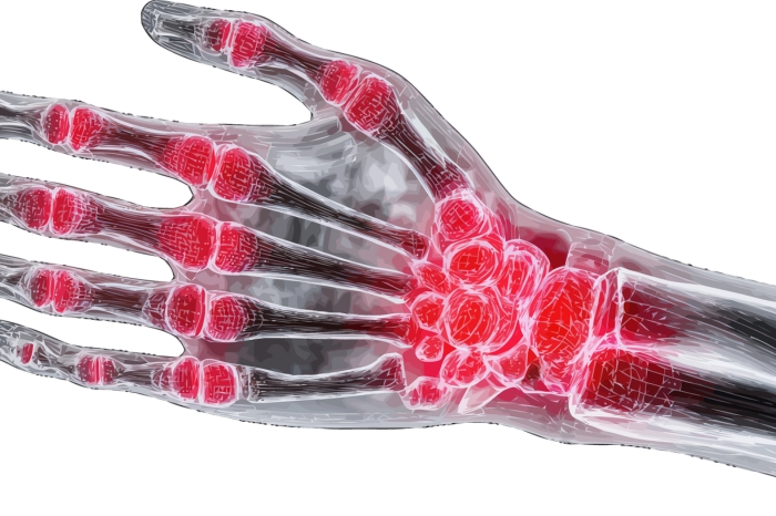 Understanding Joint Stiffness: Why It Happens and How to Restore Comfortable Movement