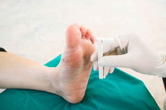 Working With Neuropathy: The Eight Hours Nobody Plans For